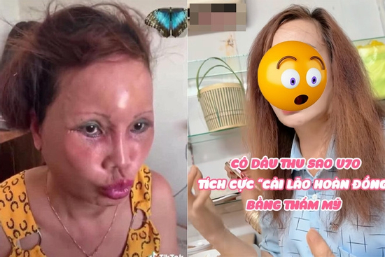 'Cô dâu Cao Bằng' lại dao kéo lần thứ 'n', diện mạo mới nhiều người ngã ngửa