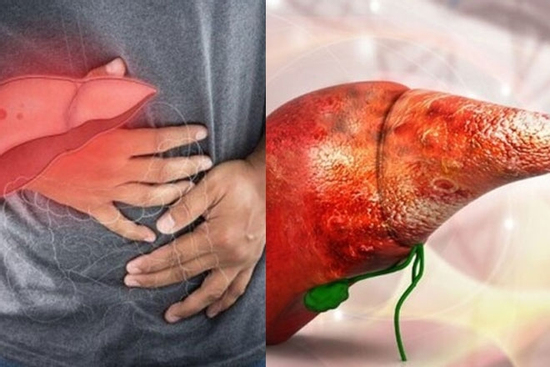 Dấu hiệu ung thư gan bạn không nên bỏ qua