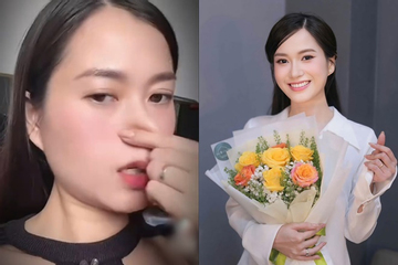 Bị nghi mới 'dao kéo' vì nhan sắc lạ hoắc, Lâm Vỹ Dạ có hành động 'phản pháo'
