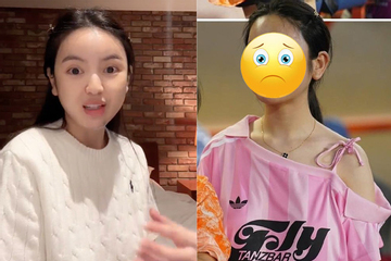 Giật mình diện mạo vợ Quang Hải qua cam thường trước khi bị biến chứng thẩm mỹ