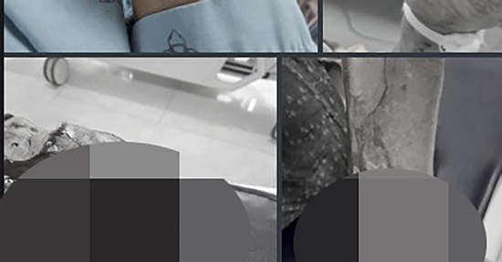 Người phụ nữ U60 chém nhau với tình địch đến nguy kịch vì ghen