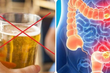 Bác sĩ chỉ cách phòng ngừa ung thư đại trực tràng
