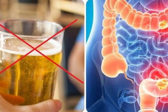 Bác sĩ chỉ cách phòng ngừa ung thư đại trực tràng