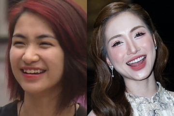 Hòa Minzy vướng nghi vấn phẫu thuật thẩm mỹ vì một điểm yếu trên gương mặt