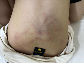 Bé gái bị đánh, kéo lê ở trường mầm non Hà Nội: Tạm đình chỉ giáo viên chứng kiến nhưng mặc kệ