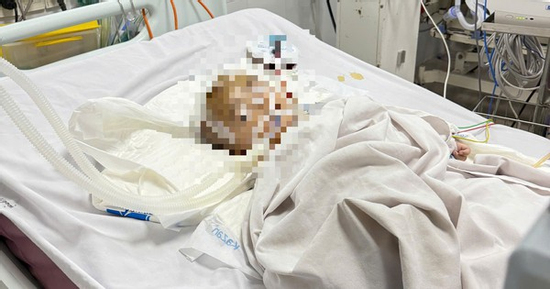 Bé trai xuất huyết não bất thường khi gửi ở nhóm nhà trẻ tự phát