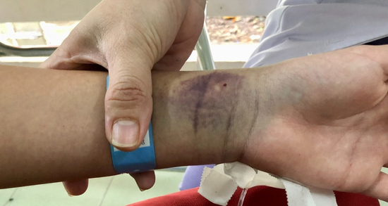 Số ca sốt xuất huyết ở Hà Nội tăng gấp đôi, 7 ổ dịch đang hoạt động