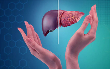 Nghiên cứu mới: Bổ sung đủ vitamin D có thể giảm 35% nguy cơ ung thư gan, 57% nguy cơ xơ gan!