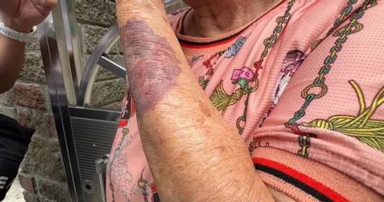 Cụ bà 80 tuổi bị nhóm thanh niên vây đánh, lý do gây phẫn nộ