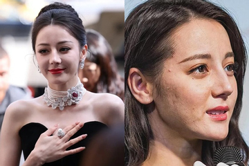 Địch Lệ Nhiệt Ba lộ làn da sần sùi, nhiều khuyết điểm qua cam thường