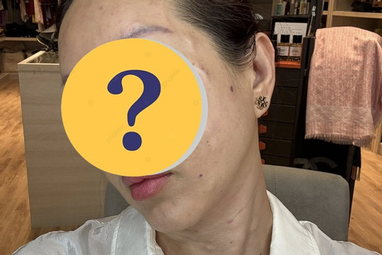 Hoa hậu Vbiz lộ diện mặt mộc tuổi U50: Tiêm sửa quá đà, chính chủ cũng 'hết hồn'