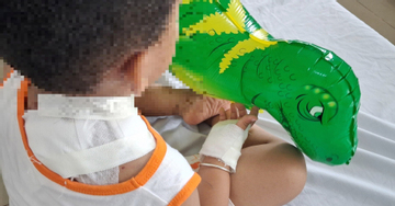 Bé trai 4 tuổi bị chó becgie của nhà cắn vào cổ và lưng