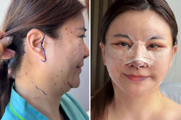 Không nhận ra diễn viên 'đanh đá nhất Việt Nam' hậu sang Hàn trùng tu toàn bộ gương mặt