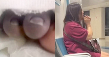 Bé trai 2 tuổi bất ngờ phát sốt, nguy cơ cắt bỏ bàn chân sau khi theo bà đi chợ