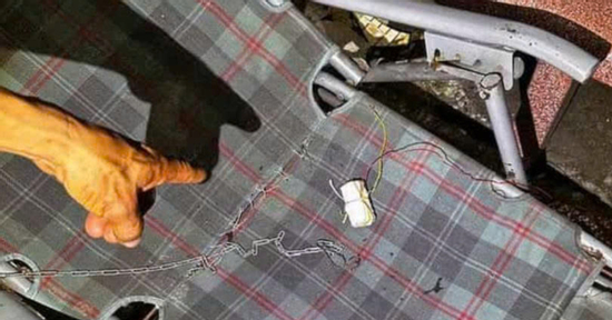 Nổ cục sạc điện thoại tự chế, người đàn ông phải bị chấn thương nặng