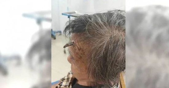 Cụ bà 98 tuổi bất ngờ 