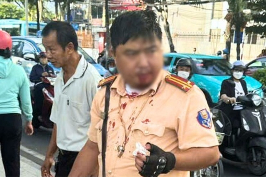 Du khách người Nga đấm CSGT Nha Trang thương tích có nồng độ cồn kịch khung