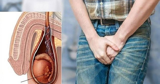 Người đàn ông 60 tuổi phát hiện ung thư tinh hoàn từ dấu hiệu nhiều nam giới Việt bỏ qua