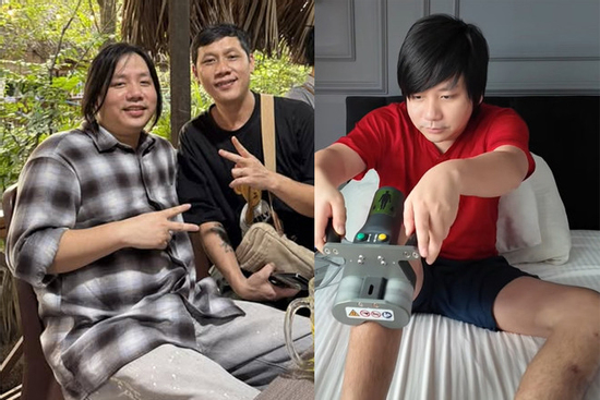 Diện mạo hiện tại của Khoa Pug sau khi chi 3 tỷ kéo chân lần 2