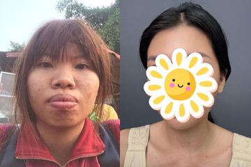 Bất ngờ diện mạo hiện tại của 'Thị Nở tái sinh' Quách Phượng sau 8 năm 'dao kéo'