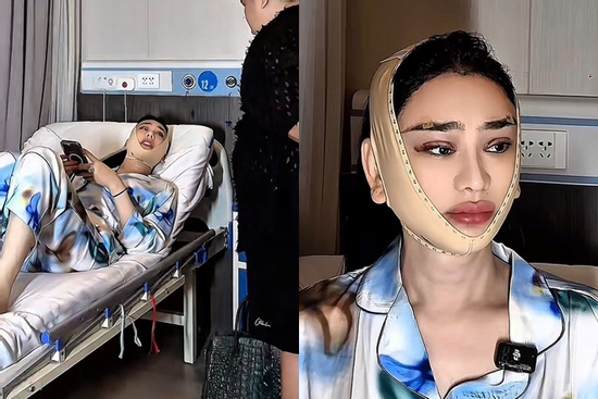 Cận gương mặt Lâm Khánh Chi sau khi sang Thượng Hải đại trùng tu nhan sắc nhiều lần