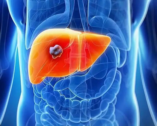 Từ viêm gan đến ung thư gan, lá gan của bạn đã trải qua những gì? 3 thói quen dễ mắc bệnh nhất