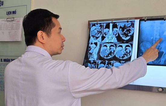 4 năm trì hoãn 'chưa đau thì không sao', người đàn ông đối diện hỏng 1 quả thận