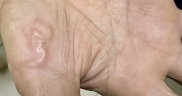 Thường xuyên ăn món 