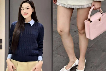 Hoa hậu Đỗ Thị Hà lộ vết thương ở chân, nguyên nhân là gì mà netizen đồng cảm?