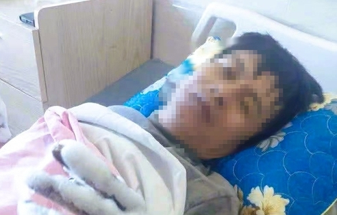 Thanh Hóa thông tin vụ nam công nhân bị điện phóng bỏng nặng 2 tay