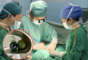 Bé gái 18 tháng tuổi nguy kịch, ruột tắc nghẽn vì nuốt hạt nở đồ chơi