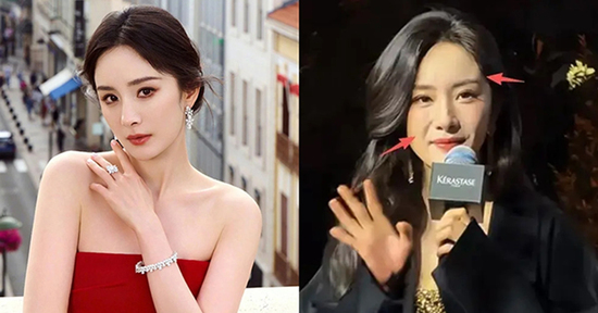 Diễn viên Dương Mịch tuổi 40 lộ gương mặt sưng phù khác lạ