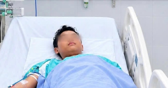 Bé trai 14 tuổi bị sét đánh ngưng tim, chuyển cấp cứu qua 3 bệnh viện