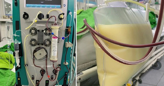 Nam sinh viêm tụy cấp, mỡ máu cao gấp 47 lần thừa nhận một sai lầm nhiều bạn trẻ Việt mắc phải