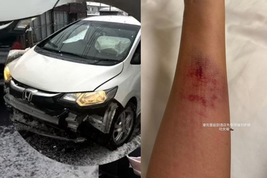 Nữ diễn viên 28 tuổi suýt mất mạng vì tai nạn, xe hư hỏng nặng