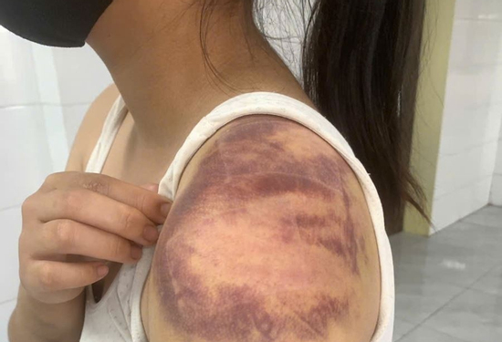 Bắt đối tượng đánh đập vợ đang mang thai và con gái 13 tuổi: Cứ vợ con làm trái ý là đánh