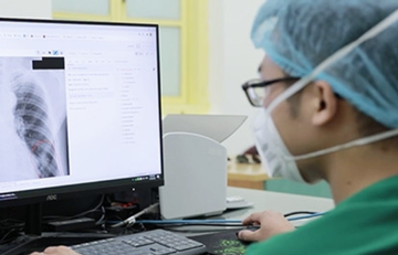 Y bác sĩ tâm tư về quy định chụp X-quang đủ 6 phút/lần mới được thanh toán BHYT