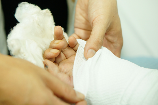 Nối thành công bàn tay của nam công nhân bị chém đứt lìa khi tăng ca đêm