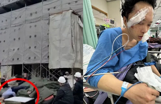 Tai nạn bất ngờ khiến nam diễn viên gãy xương mặt, hôn mê