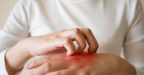 Ngứa kéo dài, vàng da, đi khám phát hiện mắc cùng lúc 2 bệnh ung thư