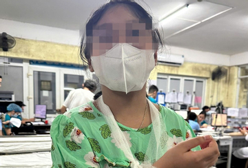 Khẩn trương xác minh vụ học sinh lớp 4 bị cô giáo đánh chấn thương tay vì quên vở