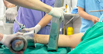 Bàn tay mắc kẹt trong máy xay thịt, người phụ nữ trẻ phải cắt cụt chi