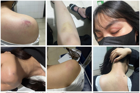 Hà Nội: Cự cãi việc để xe ven đường bị bà hàng nước thu tiền gửi, người phụ nữ bị hành hung dã man