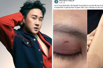 Công an xác minh thông tin ca sĩ Trung Quân Idol bị tố hành hung nữ bác sĩ