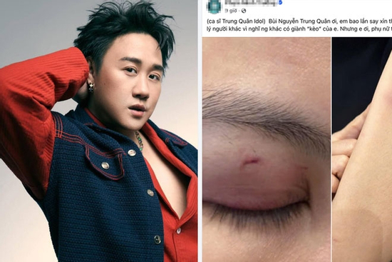 Công an xác minh thông tin ca sĩ Trung Quân Idol bị tố hành hung nữ bác sĩ
