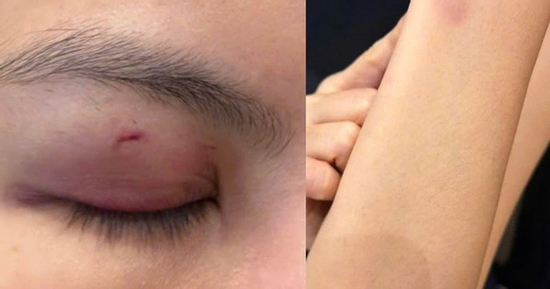 Luật sư nhận định vụ ca sĩ Trung Quân Idol bị tố đánh phụ nữ