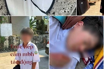 Công an vào cuộc vụ học sinh lớp 6 bị đánh hội đồng ở Nha Trang