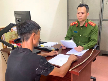 Xôn xao hình ảnh cháu bé bị bố đánh bầm tím chân tay: Công an vào cuộc làm rõ