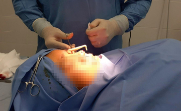 Thẩm mỹ ‘chui’ lộng hành, làm chết người: Trách nhiệm thuộc về ai?