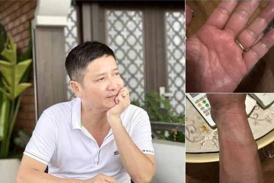 Căn bệnh NSƯT Chí Trung phải chung sống khổ sở suốt nửa năm có thật sự lạ?